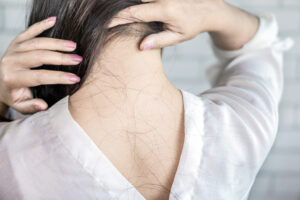 Auf dem Bild ist der Nacken einer Frau zu sehen, auf dem ausgefallene Haare liegen. 