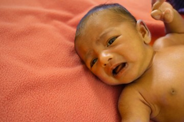 Schreiendes Baby mit gelbgefärbter Haut liegt auf einer orangen Decke. Man sieht den Kopf und den halben Oberkörper.